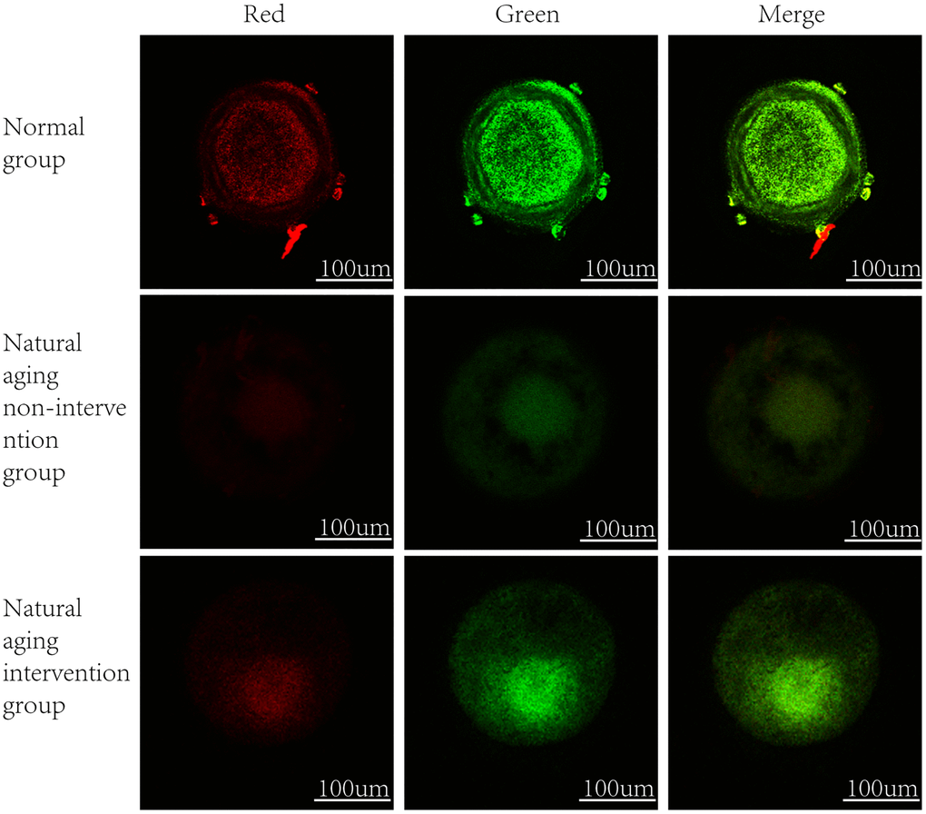 Oocyte mitochondrial membrane potential. In normal mitochondria, JC-1 gather in the mitochondrial matrix to form polymers, emit strong red fluorescence, unhealthy mitochondria due to the decline or loss of membrane potential, JC-1 in the form of monomers in the cytoplasm, produce green fluorescence.