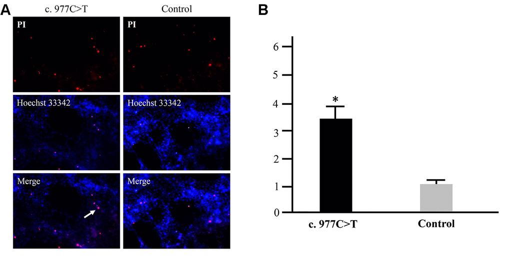 Apoptosis analysis of the mutation p.Pro326Leu. RGC-5 cells were transfected with wild-type PCK2 or p.Pro326Leu mutation, respectively. Multiple apoptotic bodies (a, pink dots) were observed in the cells transferred with p.Pro326Leu mutation (A), and the apoptosis was further proved by flow cytometry (B). *P 