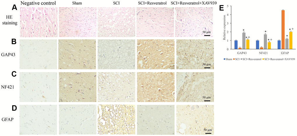 XAV939 significantly reversed the influence of resveratrol on axonal regeneration after SCI. (A) Histological changes were evaluated using HE staining; (B) The expression of GAP43 was measured using IHC staining; (C) The expression of NF421 was measured using IHC staining; (D) The expression of GFAP was measured using IHC staining; (E) The levels of GAP43, NF421, and GFAP were analyzed. *P 