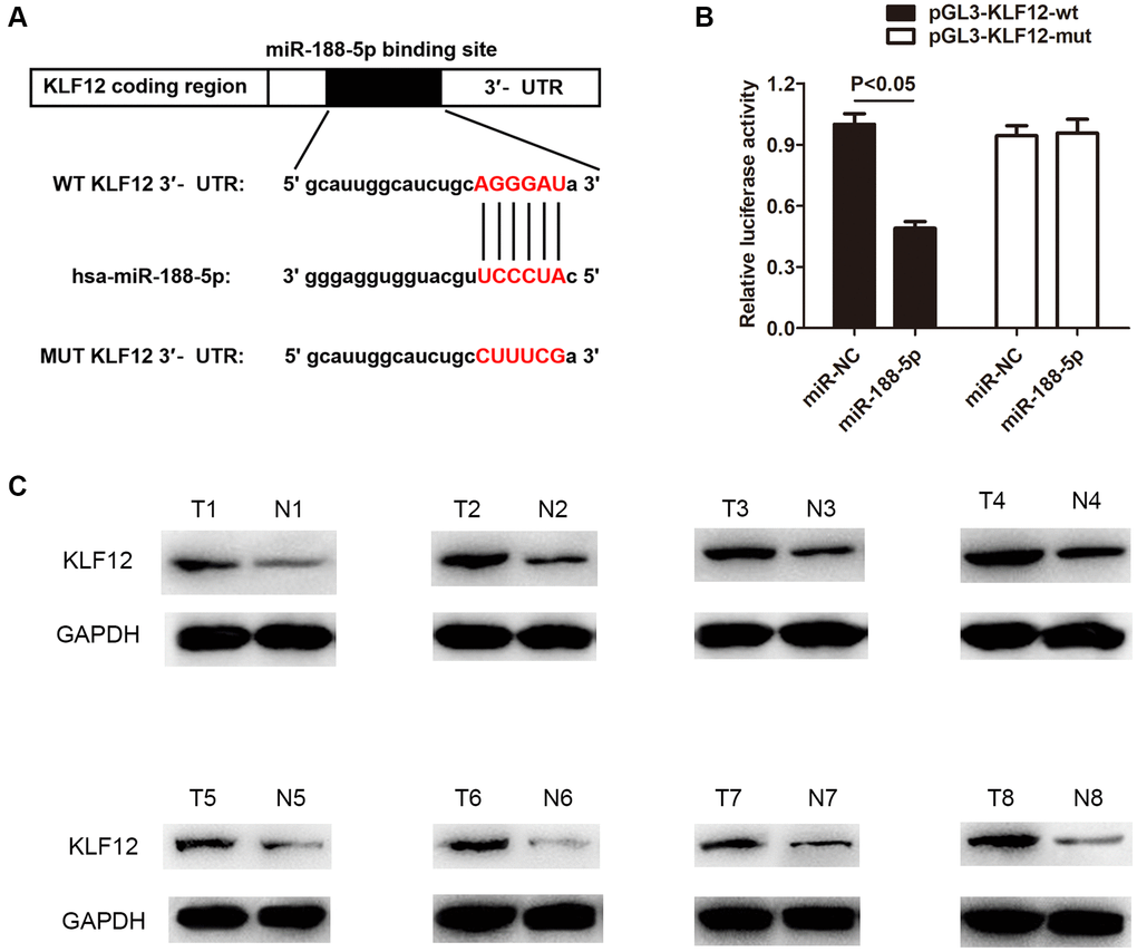 KLF12 is a negative regulatory target of miR-188-5p. (A) The binding site between KLF12 and miR-188-5p. (B) The dual-luciferase assay results confirmed the existence of direct interaction between KLF12 and miR-188-5p (p C) High expression of KLF12 in LUAD tissues was detected by western blot.
