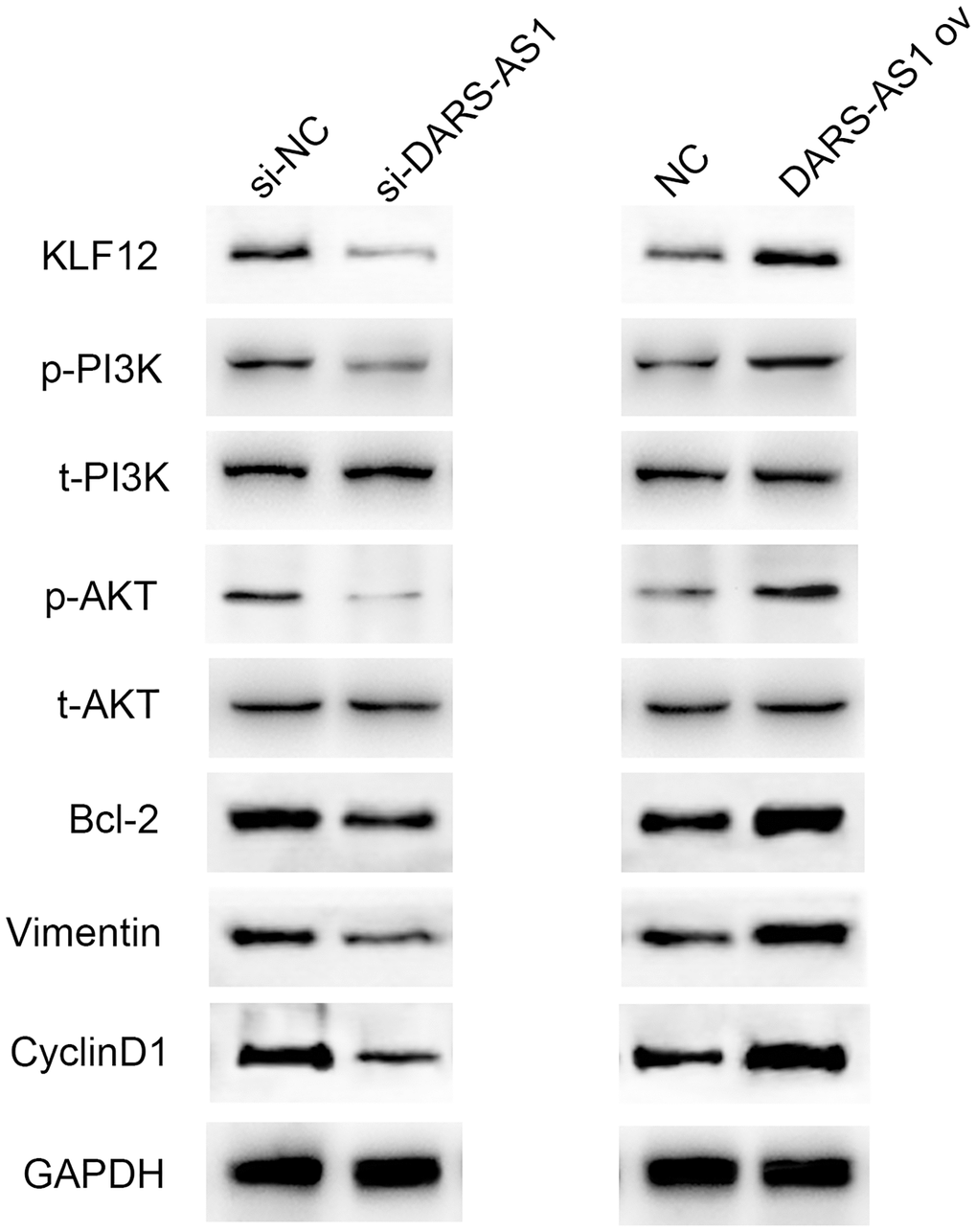 Western blot results demonstrated up-regulation of KLF12, p-PI3K, p-AKT, Bcl-2, Vimentin, and CyclinD1 in the DARS-AS1 overexpression group, while the proteins were down-regulated in the si-DARS-AS1 group.