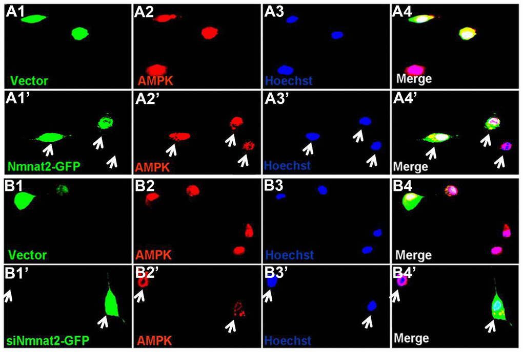 Nmnat2 up-regulates AMPK in N2a/APPswe cells. (A1–A4ʹ) N2a/APPswe cells were transfected with the empty vector (A1–A4) or Flag-Nmnat2 (Nmnat2) (A1ʹ–A4ʹ) for forty eight hours, and then AMPK was detected by immunofluorescence (IF), Nmnat2 over-expressing increased the fluorescence intensity of AMPK as shown by the white arrow (A1ʹ–A4ʹ). (B1–B4ʹ) N2a/APPswe cells were transfected with the scrambled shRNA control (Vector) (B1–B4) or shRNA-Nmnat2 (siNmnat2) (B1ʹ–B4ʹ) for forty eight hours, and then AMPK was detected by IF, knockdown of Nmnat2 decreased the fluorescence intensity of AMPK as shown by the white arrow (B1ʹ–B4ʹ). The data were representative of at least three independent experiments.