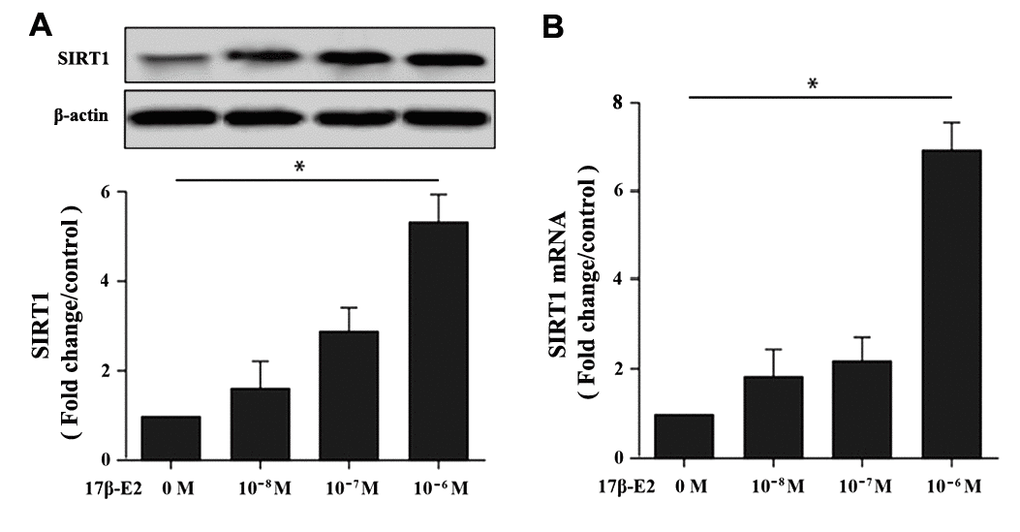 Effect of 17β-E2 on the expression level of SIRT1 in hFOB1.19 osteoblasts. (A) Western blotting showed the expression level of SIRT1 in osteoblasts treated with 17β-E2 (0, 10-8, 10-7, 10-6 M) for 24 h. Histogram showed the relative expression of SIRT1 normalized to β-actin protein, and the densitometry analysis of the blots were estimated by using Image J Software. (B) The expression of SIRT1 mRNA in osteoblasts treated with 17β-E2 (0, 10-8, 10-7, 10-6 M) for 24 h, and was assessed using RT-PCR. The data were normalized to GAPDH. Results were expressed as the means ± SD from 3 independent experiments. Statistically significance was evaluated using the Student’s t-test. * P 