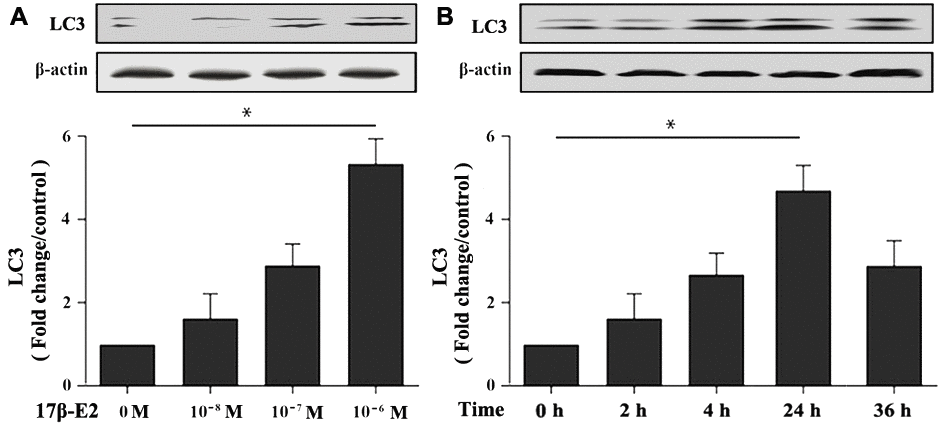 Effect of 17β-E2 on the expression level of LC3 in hFOB1.19 osteoblasts. (A) Western blotting showed the expression of LC3 protein in osteoblasts treated with 17β-E2 (0, 10-8, 10-7, 10-6 M) for 24 h. (B) Western blotting showed the expression of LC3 in osteoblasts treated with 10-6 M 17β-E2 for different time (0, 2, 4, 24, 36 h). The histograms showed the relative expression level of LC3 normalized to β-actin, and the densitometry analysis of the blots were estimated by using the Image J Software. The data were expressed as the means ± SD from 3 independent experiments. Statistically significance was evaluated using the Student’s t-test. * P 