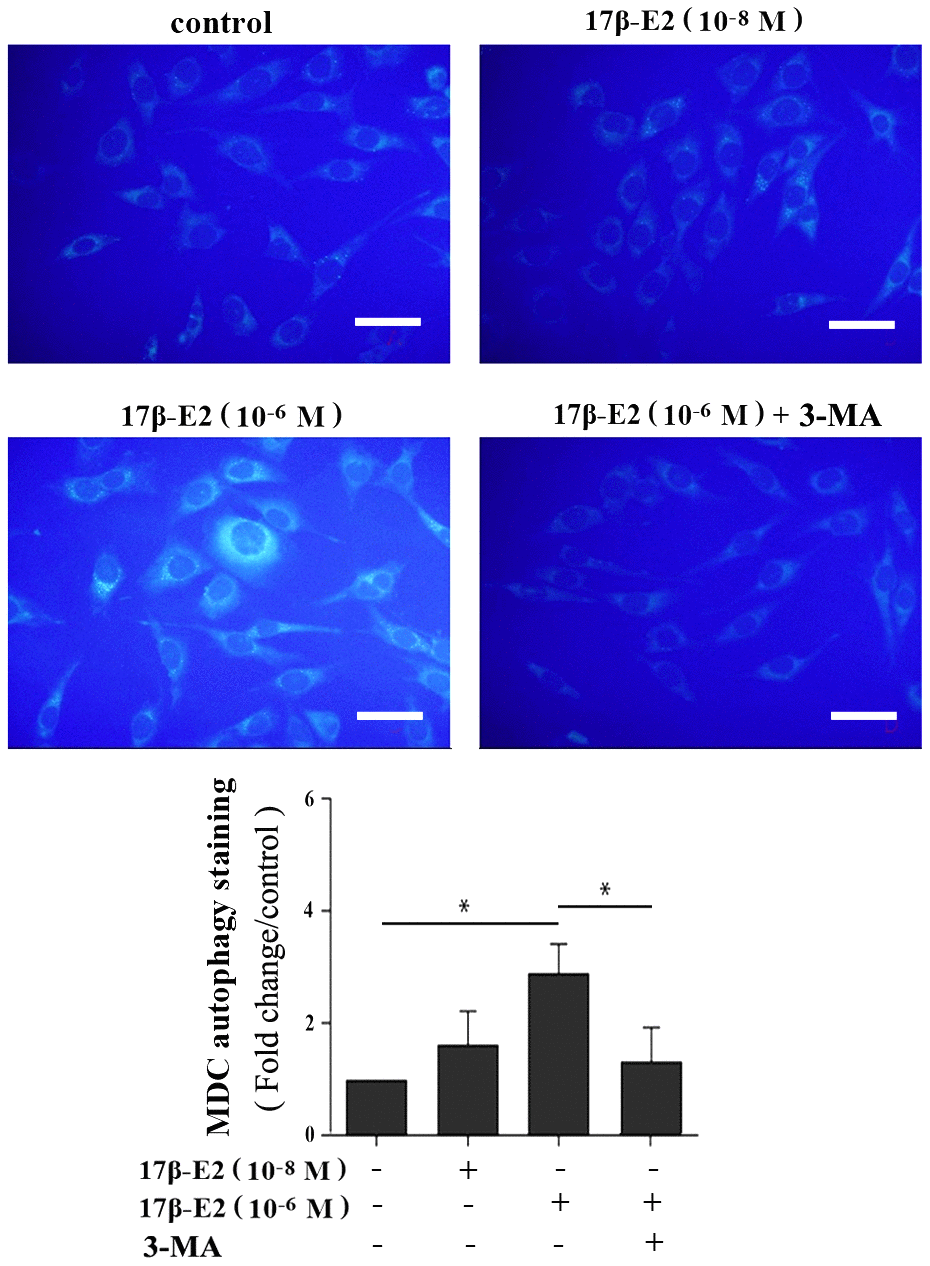 Assessment of autophagy regulated by 17β-E2 in osteoblasts using monodansylcadaverine (MDC) staining. The osteoblasts were pretreated with or without 3-MA for 2 h, and then cultured with 17β-E2 (0, 10-8, 10-6 M) for 24 h. Level of cell autophagy was evaluated by the intensity of fluorescent dots. The histogram showed that the relative intensity of fluorescent dots was significantly greater in 10-6 M 17β-E2 group than in the control group and 17β-E2 (10-6 M) + 3-MA group. Scale bar = 20 μm. The data were expressed as the means ± SD from 3 independent experiments. Statistically significance was evaluated using the Student’s t-test. * P  0.05 vs. the control group was considered significant.