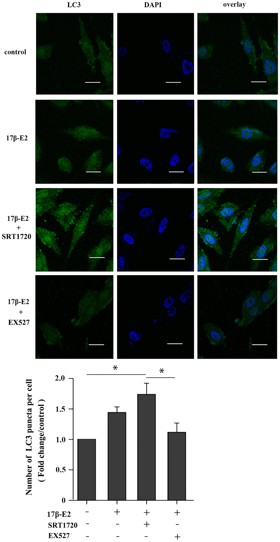 Effect of SIRT1 up-regulation induced by17β-E2 on the expression of LC3 in hFOB1.19 osteoblasts. SRT1720 or EX527 regulated the expression of LC3 in 17β-E2-treated osteoblasts, as determined using immunofluorescence staining. Nuclei were stained with DAPI (blue). Representative images and quantified analysis of immunofluorescence staining showing the LC3 in cells. White bar = 50 μm. The histogram showed the number of LC3 puncta in various groups as indicated. The data were expressed as the means ± SD from 3 independent experiments. Statistically significance was evaluated using the Student’s t-test. * P 