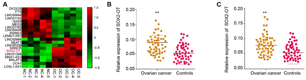 The expression of SOX2-OT is enhanced in the plasma exosome of ovarian cancer patients. (A) The lncRNA profiling was performed in the exosomes from ovarian cancer patients (n = 5) and normal controls (n = 5). (B) The expression of SOX2-OT was tested by qPCR in the plasma exosome from ovarian cancer patients (n = 55). (C) The expression of SOX2-OT was analyzed by qPCR in the ovarian cancer patients (n = 55) and the adjacent normal tissues (n = 55).
