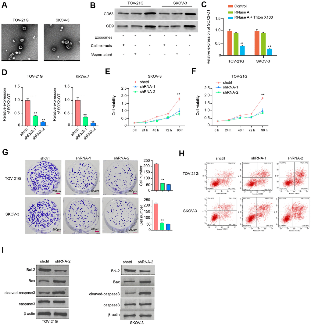 Exosomal SOX2-OT increases proliferation and attenuates apoptosis of ovarian cancer cells. (A) The characteristics of exosomes were measured by the TEM in the TOV-21G and SKOV-3 cells. (B) The expression of CD9 and CD63 was tested by the Western blot analysis in the exosome of TOV-21G and SKOV-3 cells. (C) The expression of SOX2-OT was analyzed by qPCR in the TOV-21G and SKOV-3 cells treated with RNase A (1 μg/mL) or co-treated with RNase A (1 μg/mL) and Triton X100 (0.1%). (D–I) The TOV-21G and SKOV-3 cells were treated with the SOX2-OT shRNA or control shRNA, and the exosomes were extracted and further treated the cells. (D) The efficiency of the SOX2-OT knockdown was confirmed by qPCR assays in the cells. (E, F) The cell viability was assessed by the MTT assays in the cells. (G) The cell proliferation was determined by colony formation assays in the cells. (H) The cell apoptosis was examined by flow cytometry analysis in the cells. (I) The expression of Bcl-2, Bax, cleaved-caspase3, and caspase3 was measured by Western blot analysis in the cell. Data are presented as mean ± SD. Statistic significant differences were indicated: * P P P 