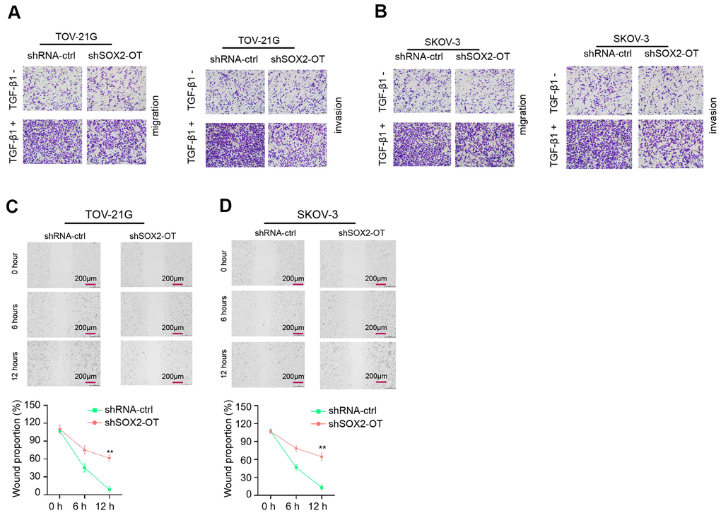 Exosomal SOX2-OT induces invasion and migration of ovarian cancer cells. (A–D) The TOV-21G and SKOV-3 cells were treated with control shRNA or SOX2-OT shRNA, and the exosomes were extracted and further treated the cells. (A, B) The cells were treated with or without TGF-β1 (5 ng/ml). The cell migration and invasion were analyzed by transwell assays in the cells. (C, D) The migration and invasion were determined by wound healing assays in the cells. The wound healing proportion was shown. Data are presented as mean ± SD. Statistic significant differences were indicated: * P P 