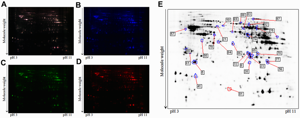 A typical 2D-DIGE gel images of hippocampal proteins obtained from the 3xTg-AD mice treated with or without loganin (n = 6 for each group). (A) The merged image displaying Cy2-, Cy3-, and Cy5-labeled proteins. (B) the typical gel image of Cy2-labeled proteins. (C) the typical gel image of Cy3-labeled proteins of the 3xTg-AD mice. (D) the typical gel image of Cy5-labeled proteins of the 3xTg-AD mice treated with loganin. (E) Greyscale 2D-DIGE gel image showing the differentially expressed proteins from the hippocampus of 3xTg-AD mice treated with loganin compared to the control mice.