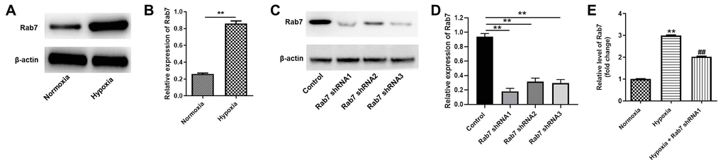 Rab7 expression was upregulated in HK-2 cells under hypoxia condition. HK-2 cells were maintained in normoxia or hypoxia condition. Then, (A, B) the protein expression of Rab7 in HK-2 cells was detected by western blot. β-actin was used for quantification. (C, D) HK-2 cells were transfected with Rab7 shRNA1, Rab7 shRNA2 or Rab7 shRNA3. The protein level of Rab7 in HK-2 cells was investigated by western blot. β-actin was used for quantification. (E) HK-2 cells in hypoxia condition were treated with Rab7 shRNA1. The level of Rab7 in HK-2 cells was tested by RT-qPCR. **P##P