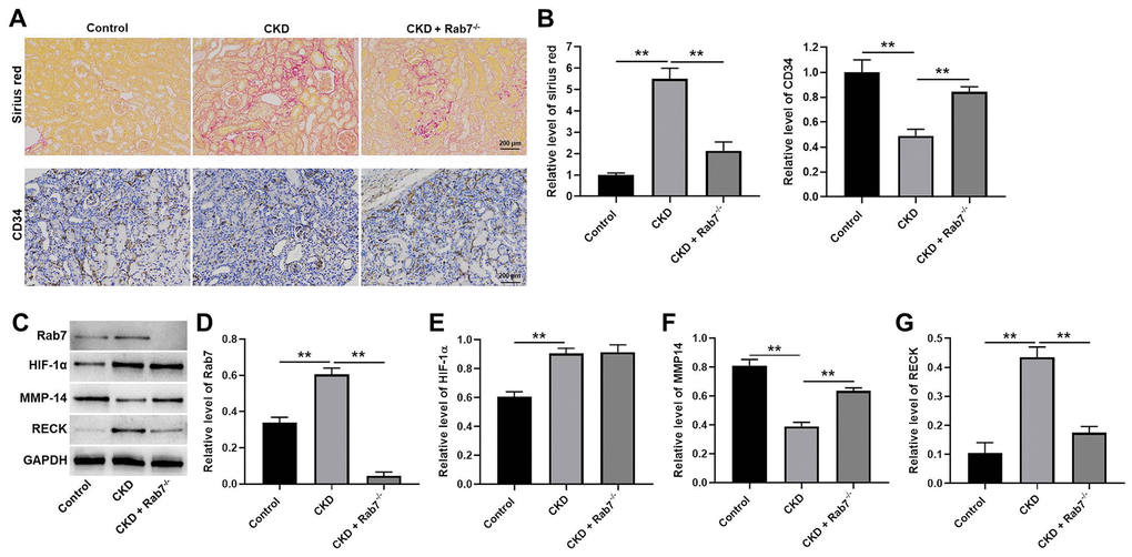 Knockdown of Rab7 significantly alleviated the symptom of CKD in vivo. (A, B) Sirius red staining was used to detect the fibrosis in kidney tissues of mice. The level of CD34 in kidney tissues of mice was detected by IHC staining. (C) The protein levels of HIF-1α, Rab7, MMP-14 and RECK in kidney tissues of mice were detected by western blot. (D–G) β-actin was used for quantification. **P