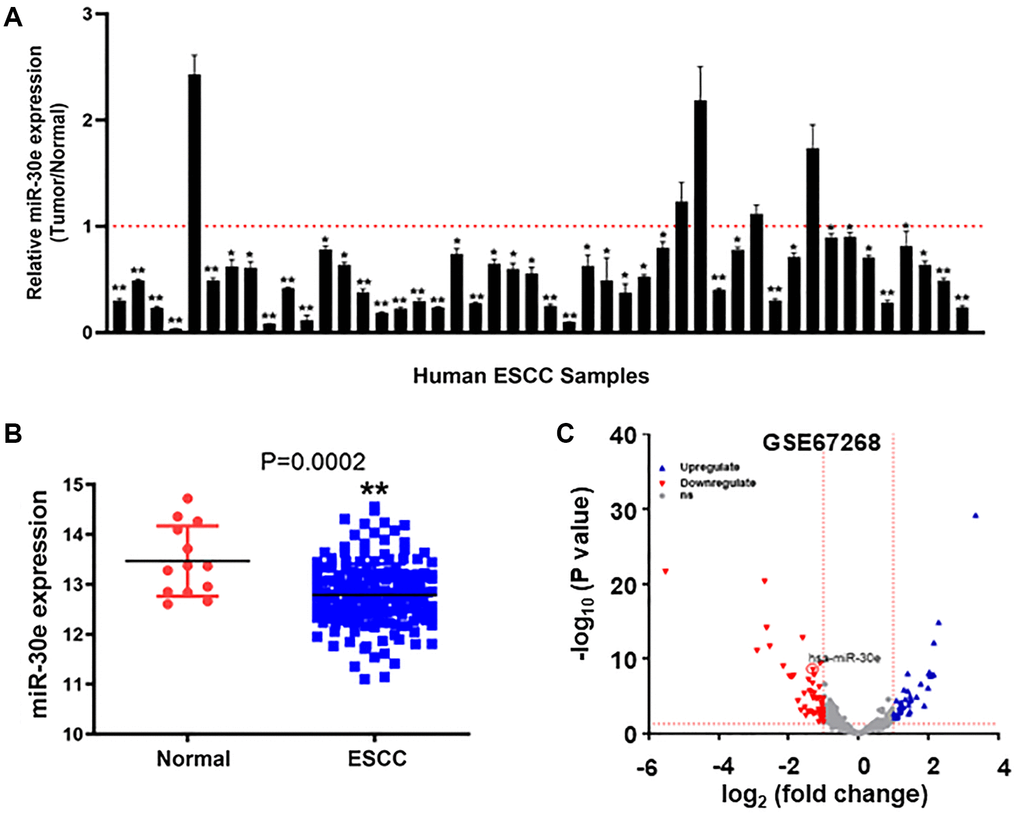 MiR-30e expression was downregulated in human esophageal carcinoma tissues compared to normal adjacent esophageal tissues. (A) The relative expression levels of miR-30e were detected by qRT-PCR and normalized to an endogenous control (U6 RNA) in 46 pairs of human esophageal carcinoma tissues. The results represent the ratio of miR-30e levels in tumor tissues to adjacent normal tissues. (B) Relative expression levels of miR-30e in of 185 human esophageal carcinoma tissues were compared with 13 normal tissues in TCGA database (https://xenabrowser.net/datapages/). (C) The miR-30e expression levels of adjacent normal esophageal tissues and esophageal carcinoma tissues were analyzed in the public GEO dataset (GSE67268, https://www.ncbi.nlm.nih.gov/geo/). Data represent mean ± SD of 3 replicates. *indicates significant difference at P **indicates significant difference at P 