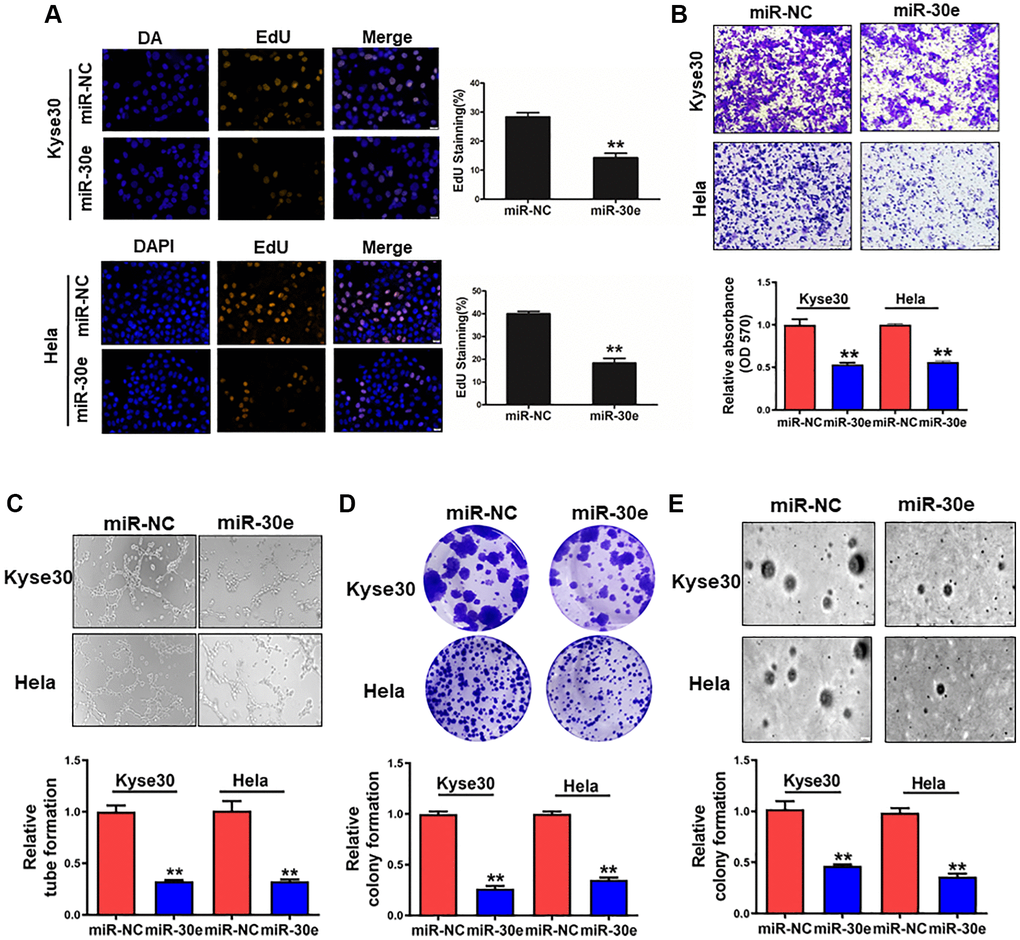 MiR-30e overexpression inhibited cell proliferation, invasion, tube formation and colony formation of cancer cells. (A) Human esophageal cancer Kyse30 cells and cervix cancer Hela cells were transfected with negative control miRNA (miR-NC) and miR-30e mimic, and the cells were cultured and stained using EdU. Immunofluorescence images of EdU, a cell proliferation marker, were analyzed in Kyse30 and Hela cells. (B) These cells were used to study cell invasion using the Transwell chambers with pre-coated Matrigel. (C) Conditioned media were collected from Kyse30 and Hela cells overexpressing miR-30e and miR-NC. HUVECs were used to test tube formation using the conditioned media obtained above. (D) Indicated cells were used for clonogenic assay. (E) Indicated cells were used for colony formation assay. Data represent mean ± SD of 3 replicates. **indicates significant difference at P 