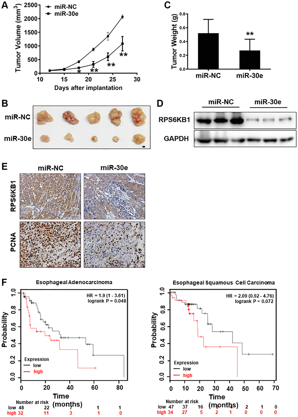 MiR-30e inhibited tumor growth and RPS6KB1 expression, and higher levels of RPS6KB1 were associated with lower esophageal cancer survival rate. (A) Kyse30 cells were infected with lentivirus expressing miR-30e or miR-NC, and cells stably expressing miR-NC and miR-30e termed as Kyse30/miR-NC and Kyse30/miR-30e were obtained after puromycin selection. Cells (5 × 106 cells) in 100 μl of serum-free DMEM medium were subcutaneously injected into posterior flanks on both sides of the nude mice (n = 5). Tumors were measured every three days after they were visible starting on Day 12. Tumor volumes were calculated using the following formula: volume = 0.5 × (length × width2). (B) Representative pictures of tumors. Bar = 2 mm. (C) The weights of tumors from miR-30e and miR-NC groups were measured. (D) The total proteins were extracted from xenografts and subjected to Western blotting analysis to test levels of RPS6KB1. GAPDH levels were used as an internal control. (E) The expression levels of RPS6KB1 and PCNA in tumor tissues were analyzed by immunohistochemical (IHC) staining. (F) The Kaplan Meier plotter was used to detect the correlation between overall survival (OS) and RPS6KB1 expression levels in esophageal adenocarcinoma and esophageal squamous cell carcinoma tissues, respectively. Data represent mean ±SD of 3 replicates. *,**indicates significant difference at P P 