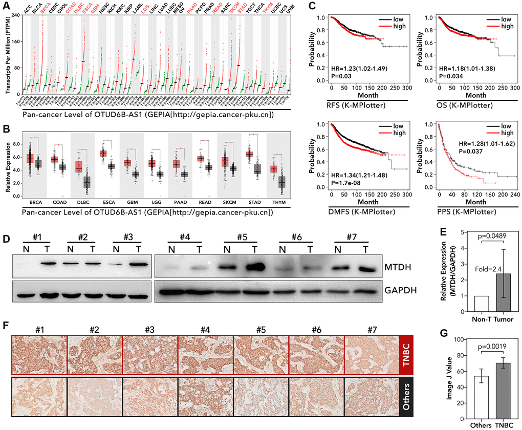 The expression level of MTDH and its molecular function in tumor. (A and B) Pan-cancer analysis about the expression level of MTDH, data from GEPIA (http://gepia.cancer-pku.cn). (C) The recurrence-free survival (RFS), overall survival (OS), disease metastasis-free survival (DMFS), and post-operation progressive survival (PPS) of MTDH in breast cancer, data from K-MPlotter (http://kmplot.com/analysis/index.php?p=background). (D and E) The expression level of MTDH in frozen TNBC tissues and adjacent tissues, detected by WB. (F and G) The expression level of MTDH in TNBC and other types of breast cancer, detected by IHC.