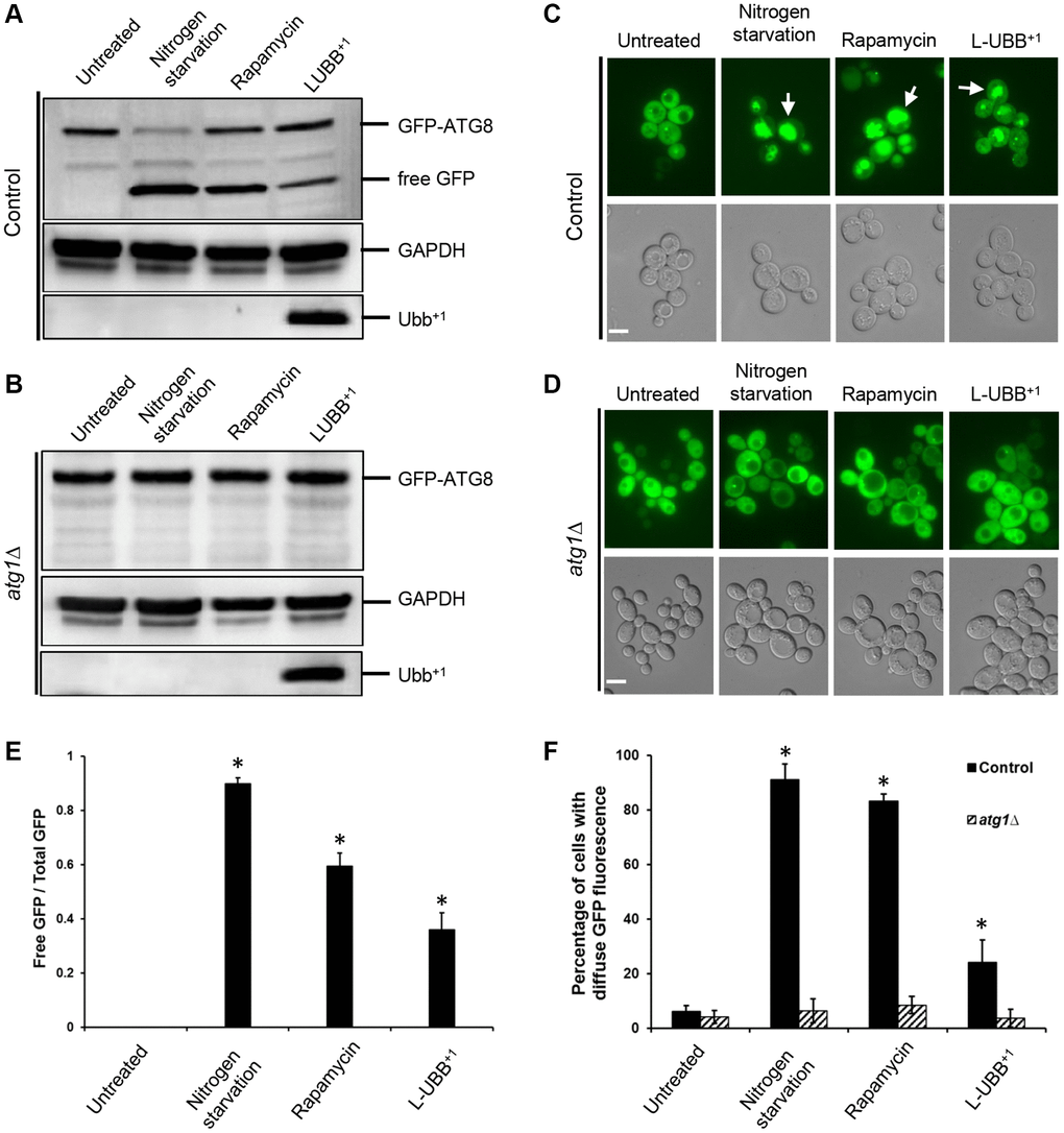Low UBB+1 expression activates autophagy. (A–B) Western blot of GFP-Atg8p processing into free GFP. GAPDH was used as the loading control. (C–D) Translocation of GFP-Atg8p into yeast vacuole. Top panel: images from FLUO-GFP filter. Bottom panel: images from DIC filter. White arrow: GFP fluorescence inside vacuole. Scale bar = 5 μm. (E) The ratio of free GFP to total GFP (uncleaved GFP-ATG8 + free GFP) under wild type background was calculated and presented based on (A). Data is shown as average values ± SD from biological triplicates. (F) The percentage of cells with diffuse vacuolar GFP fluorescence was counted and represented based on (C–D). Above 200 cells were count per sample (n = 3 ± SD). The asterisk (*) indicates a statistically significant p-value of 