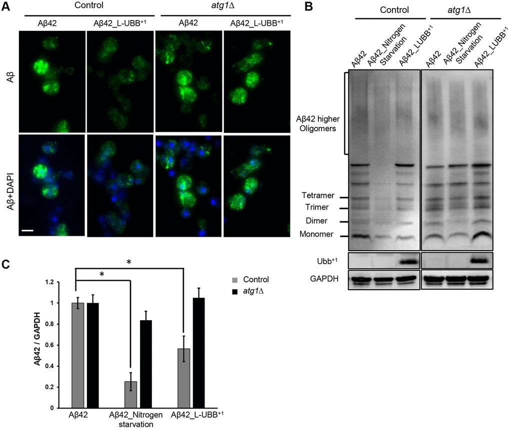 Low UBB+1 expression reduces Aβ42 levels in the humanized yeast AD model. (A) Immunostaining analysis of Aβ42 localization and expression using the 6E10 Aβ specific antibody. Nuclei were stained blue by DAPI. Scale bar = 5 μm. (B) Western blot analysis of Aβ42 expression in unboiled cell lysates with 6E10 antibody. GAPDH was used as the loading control. (C) Relative Aβ42 band intensity was normalized to GAPDH and compared to the untreated Aβ42 strain. Results are reported as mean ± SD of three independent experiments. *p 