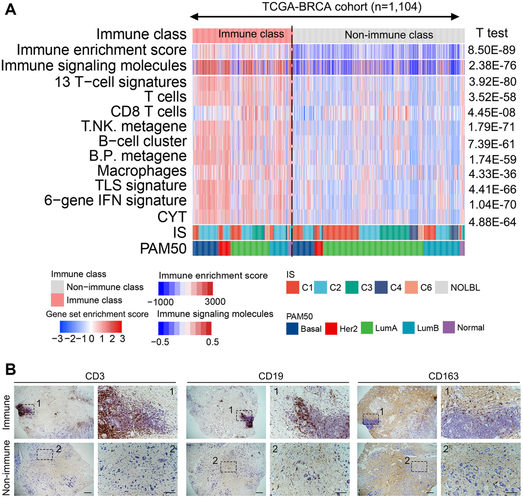 Identified immune-related subclasses of patients with breast cancer. (A) Consensus-clustered heatmap on the TCGA-BRCA cohort (n = 1,104) based on the example genes of immune factors selected by NMF, and refine it through the multidimensional scaling random forest to define the immune class (407/1104, 36.9%, pink bar). Immune-related signatures were compared between immune and non-immune classes. Red and blue bars correspond to high and low scores of each signature, respectively. (B) Representative images of CD3, CD19, and CD163 (markers of T, B, and myeloid cells, respectively) staining in the immune and non-immune classes. Scale bar, 100 μm. Abbreviations: IFN: interferon; TLS: tertiary lymphoid structure; CYT: cytolytic activity score; NMF: non-negative matrix factorization; TCGA–BRCA: The Cancer Genome Atlas-Breast Cancer.