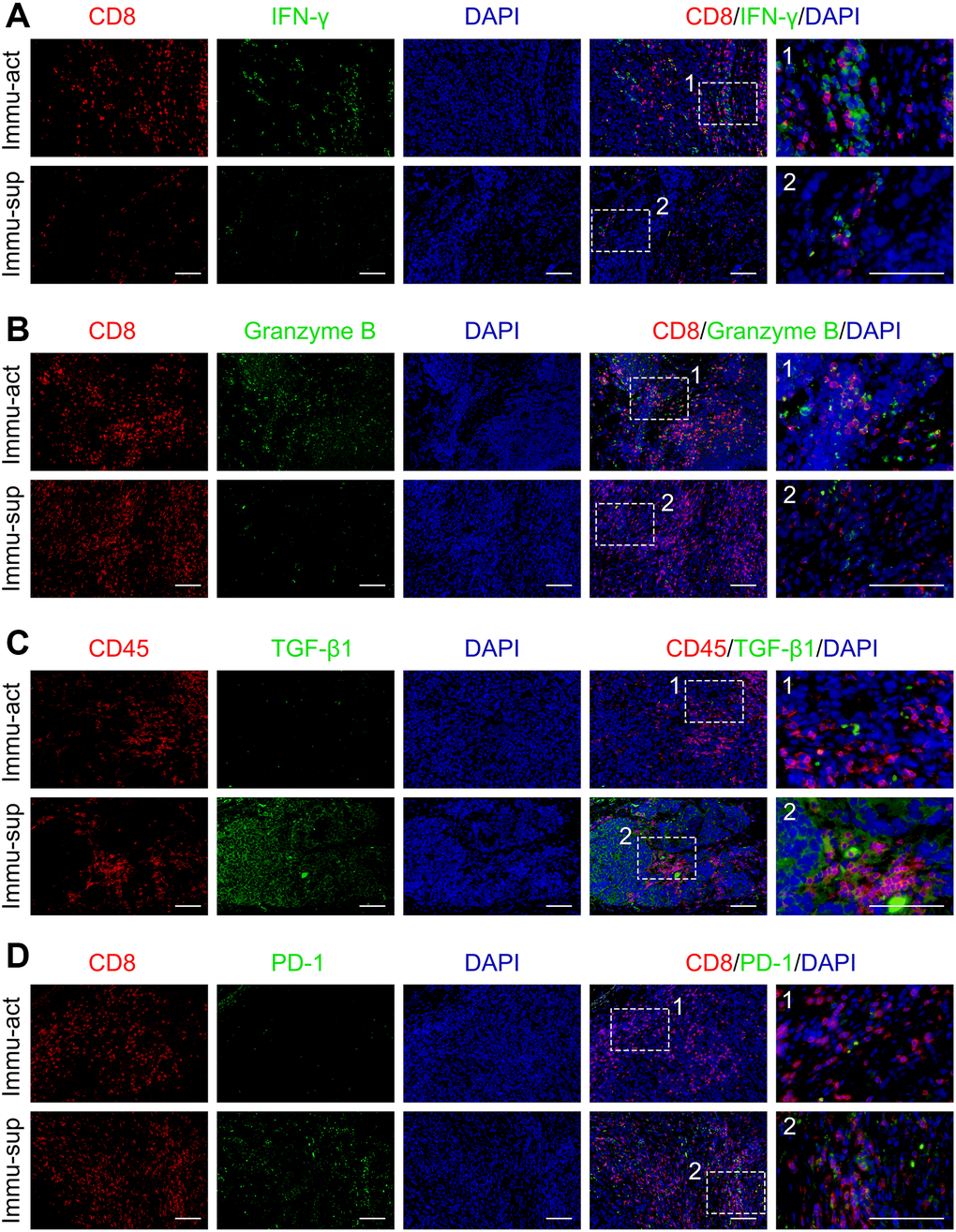 Immune-activated and -suppressed status of the tumor niche. (A) Co-staining of CD8 and IFN-γ in immune-activated and -suppressed patients. (B) Co-staining of CD8 and granzyme B in immune-activated and -suppressed patient samples. (C) Co-staining of CD45 and TGF-β1 in immune-activated and -suppressed patient samples. (D) Co-staining of CD8 and PD-1 in immune-activated and -suppressed patient samples. Scale bar, 100 μm. Abbreviations: Immu-act: immune-activated; Immu-sup: immune-suppressed.