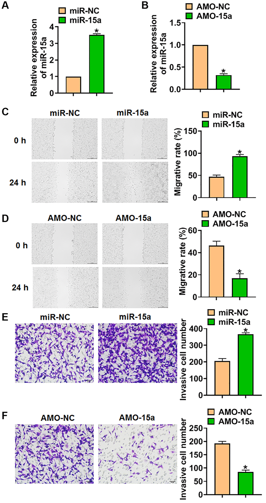Silencing of miR-15a inhibited the malignancy of SHG139 cells. (A) SHG139 cells were transfected with miR-15a or its negative control (miR-NC), and qRT-PCR used to test the transfection efficiency. (B) AMO-15a or its negative control (AMO-NC) were transfected into SHG139 cells, and miR-15a level in SHG139 cells were detected. (C) Wound healing assay was used to detect cell migration. Scale bar, 200 μm. (D–F) Transwell assay was performed to identify the invasion of SHG139 cells. Scale bar, 50 μm. Data were expressed as mean ± SD.*P 