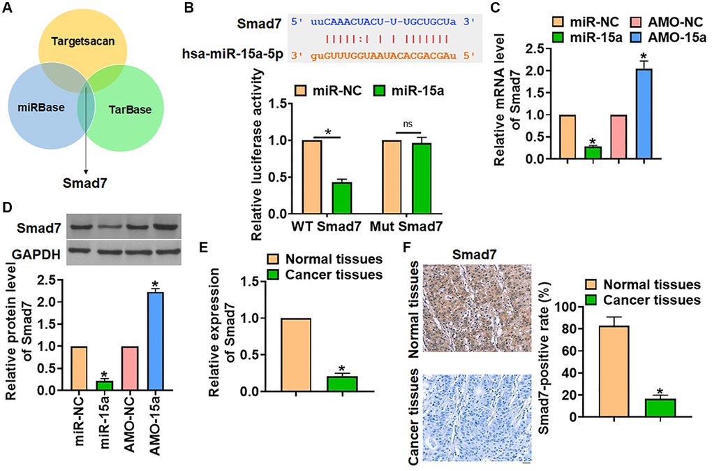 Smad7 was the target of miR-15a in glioma progression. (A) The miRBase, Targetscan and Tarbase were used to search the predicted target of miR-15a, and Smad7 has the has the greatest potential. (B) The binding bases between miR-15a and Smad7 (upper), and luciferase assay used to test the activity of WT Smad7 and Mut Smad7 (lower) in HEK193 cells. SHG139 cells were transfected with miR-15a or AMO-15a, and the mRNA (C) and protein (D) level of Smad7 was explored. (E) The mRNA expression of Smad7 in in adjacent normal tissues and cancer tissues of glioma was determined. (F) IHC staining used to examine the expression of Smad7 in different grades of glioma tissues, and relative Smad7 positive area was calculated. Scale bar, 30 μm. Data were expressed as mean ± SD.*P 