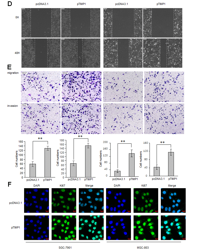 TIMP1 promotes GC proliferation, migration and invasion. SGC-7901 and MGC-803 cells were transduced with TIMP1 expression plasmid (pTIMP1) or pcDNA3.1 as indicated. (D, E) Cell metastasis was determined by Scratch wound assays (D) or Transwell migration and Matrigel invasion assays (E). (F) The expression levels of the cell proliferation marker Ki67 were detected by immunofluorescence. Data represent the means ± SEM. **P 
