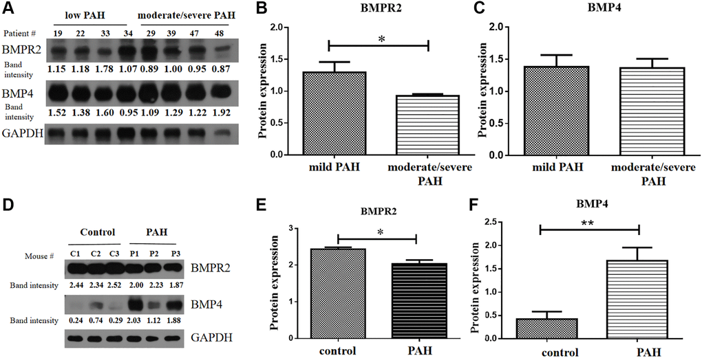 BMPR2 was downregulated in human PAH patients as well as in the PAH model mice. (A–C) Western blot analysis of human patient samples. (A) Western blot analysis was carried out to examine BMPR2 and BMP4 protein levels in the heart valve tissues samples derived from the human PAH patients after surgery with mild (30 mmHg ≤ PASP Figure 6B for BMPR2 and Figure 6C for BMP4. Mild PAH, patients with low PASP. Moderate/severe PAH, patients with moderate to severe PASP. (D–F) Western blot analysis of mouse PAH samples. (D) Western blot analysis was carried out to examine BMPR2 and BMP4 protein levels in the heart tissues samples derived from the PAH model mice. The band intensities of BMPR2 and BMP4 in three control (C1, C2, C3) and three PAH model mice (P1, P2, P3) were normalized to those of GAPDH on the western blots based with the ImageJ analysis. The numbers are shown for each band of BMPR2 and BMP4 in the PAH model mice. These normalized protein levels are shown in Figure 6E for BMPR2 and Figure 6F for BMP4. Statistical analysis: *P **P 