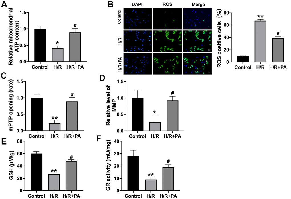 PA improves mitochondrial function in H/R NMVCs. (A) The ATP content was explored in NMVCs. n=4, *P#PB) The ROS production in NMVCs was determined. Scale bar 20 μm. n=4, **P#PC) The mPTP opening rate in NMVCs was explored. n=5, **P#PD) Mitochondrial membrane potential detection in NMVCs. n=4, *P#PE) and GR activity (F) in NMVCs. n=4, **P#P