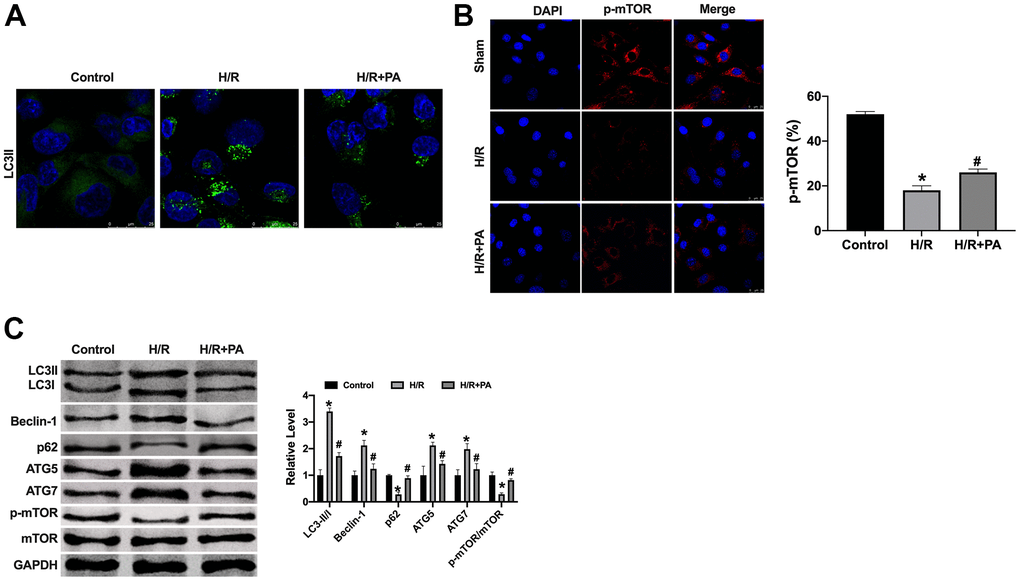 PA inhibited the excessive autophagy in H/R NMVCs. (A, B) Immunofluorescence assay for LC3II and p-mTOR in NMVCs. Scale bar 20 μm. (C) The protein level of LC3, Beclin-1, p62, ATG5, ATG7, mTOR in NMVCs. n=4, *P#P