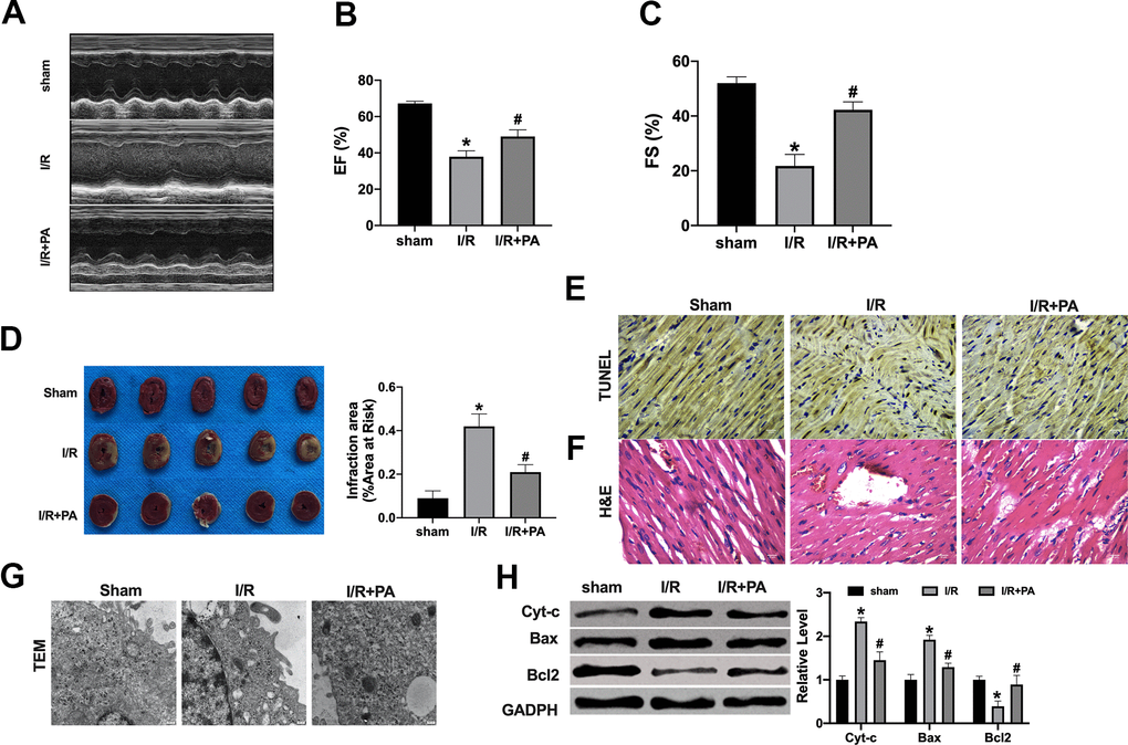 PA ameliorates cardiac function in I/R mice. (A) Cardiac function was detected by echocardiography measurement: EF (B) and FS (C). (D) Infarct sizes as the percent of area at risk (AAR). n=4. *P#PE) Representative images of TUNEL staining. (F) Respective HE-stained images of hearts. (G) Transmission electron microscopy was used to detect mitochondrial morphology. (H) The apoptosis-associated protein level in cardiac tissues, Cytochrome-c (Cyt-c), Bax, and Bcl2. n=4, *P#P