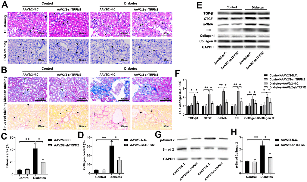 TRPM2 silencing attenuated renal damage in mice with HFD/STZ-induced diabetes. (A) HE and PAS staining of mouse kidney specimens in the four treatment groups in the 24th week (▼indicates renal glomeruli, ˃ indicates renal tubules). (B–D) Fibrosis was determined by Masson and Sirius red staining in the four treatment groups (▼ indicates renal glomeruli, ˃ indicates renal tubules, ↓ indicates renal interstitials). (E, F) Protein assay was implemented to evaluate the protein levels of TGF-β1, CTGF, α-SMA, FN, Collagen I and Collagen III in the renal specimens from the four treatment groups. (G, H) Protein assays were conducted to evaluate the protein levels of P-Smad2 and Smad2 in the renal specimens of the four treatment groups. The data are shown as the mean ± SD, n = 6 per group; *p 