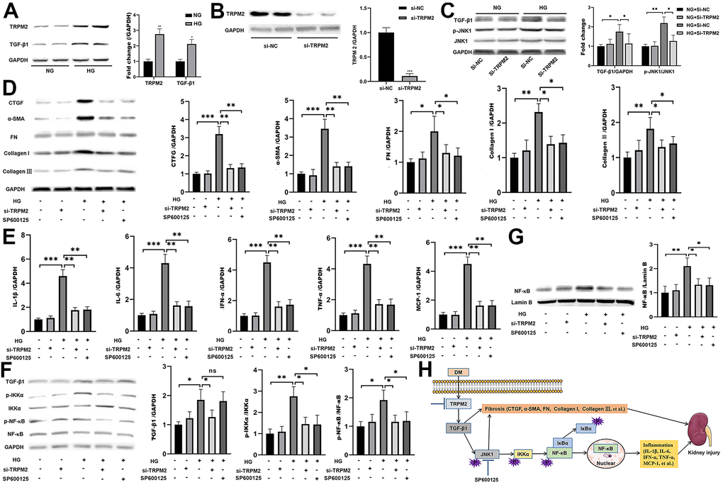 The protective effect of TRPM2 knockdown in DN by blocking TGF-β1-activated JNK1 activation. (A) Protein assay of TRPM2 and TGF-β1 expression in HK-2 cells stimulated with HG for 24 h. (B) Protein analysis was utilized to confirm the efficacy of TRPM2 silencing in HK-2 cells transfected with si-TRPM2. (C) HK-2 cells were instantly transfected with si-TRPM2 or Si-NC for 48 h, followed by NG or HG treatment for another 24 h. The protein levels of TGF-β1 and p-JNK1 were detected by protein assay. (D) HK-2 cells were instantly transfected with si-TRPM2 or Si-NC for 48 h, followed by NG or HG treatment for another 24 h. In another experimental group, HK-2 cells were incubated with 10 μM SP600125 (a JNK inhibitor) for 1 h, followed by HG treatment for 24 h. Protein assay of CTGF, α-SMA, FN, Collagen I and Collagen III expression in HK-2 cells. (E) qRT-PCR analysis of IL-1β, IL-6, IFN-α, TNF-α and MCP-1 expression in HK-2 cells. (F) Protein assay of TGF-β1, p-IKKα and p-NF-κB expression in HK2 cells. (G) Protein assay of the NF-κB levels in the nuclei of HK2 cells. (H) The protective effect of TRPM2 knockdown in DN by blocking TGF-β1-activated JNK1 activation. The data are shown as the mean ± SD of three independent experiments; *p 