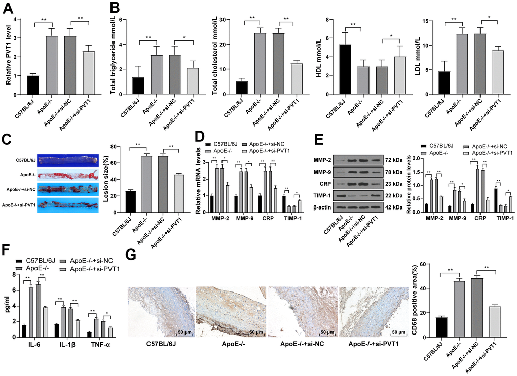 Silencing PVT1 reduces AS damage in ApoE-/- mice. ApoE-/- mice were fed with high-fat diet for 12 weeks. (A) Relative PVT1 expression in mice detected by qRT-PCR; (B) Levels of TG, TC, HDL, and LDL detected by ELISA; (C) Lipid accumulation on the aortic wall detected by oil red O staining; (D) mRNA levels of MMP-2, MMP-9, CRP, and TIMP-1 detected by qRT-PCR; (E) Protein levels of MMP-2, MMP-9, CRP and TIMP-1 detected by Western blot; (F) Levels of IL-6, IL-1β, and TNF-α detected by ELISA; (G) CD68 positive cells detected by immunohistochemistry. N = 6. Data were presented as mean ± standard deviation. Comparisons among multi-groups were analyzed using one-way ANOVA, followed by Tukey’s multiple comparisons test. * p  0.05, ** p  0.01. PVT1, plasmacytoma variant translocation 1; AS, atherosclerosis; ApoE-/-, apolipoprotein E knockout; TG, total triglyceride; TC, total cholesterol; HDL, high density lipoprotein; LDL, low density lipoprotein; MMP, matrix metalloproteinase; TIMP-1, tissue inhibitor of metalloproteinase-1; CRP, C-reactive protein; IL, interleukin; TNF-α, tumor necrosis factor-alpha.