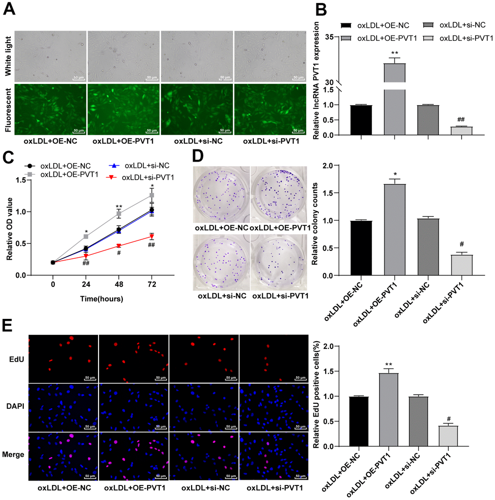 Silencing PVT1 induced by siRNA inhibits the activity and proliferation of HA-VSMCs. (A) Fluorescence of GFP ensures the recombinant plasmid was transfected properly; (B) Relative expression of PVT1 detected by qRT-PCR; (C) Cell viability measured by MTT assay; (D) Cell colony formation ability detected by colony formation assay; (E) DNA replication activity detected by EdU assay. Compared to the oe-NC group, * p p p p 