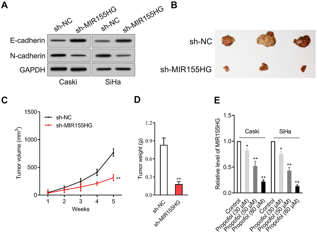 MIR155HG expression is reduced by propofol. (A) Caski and SiHa was transfected with sh-MIR155HG. The expressions of N-cadherin and E-cadherin were detected using immunoblotting. (B) Photographs of representative tumor tissue in tumor xenografts five weeks after subcutaneous inoculated sh-NC or sh-MIR155HG transfected SiHa cells. (C) Quantitative analysis of tumor volume. (D) Quantitative analysis of tumor weight. **PE) MIR155HG expressions in propofol-treated Caski and SiHa cells were determined by qRT-PCR. *P**P