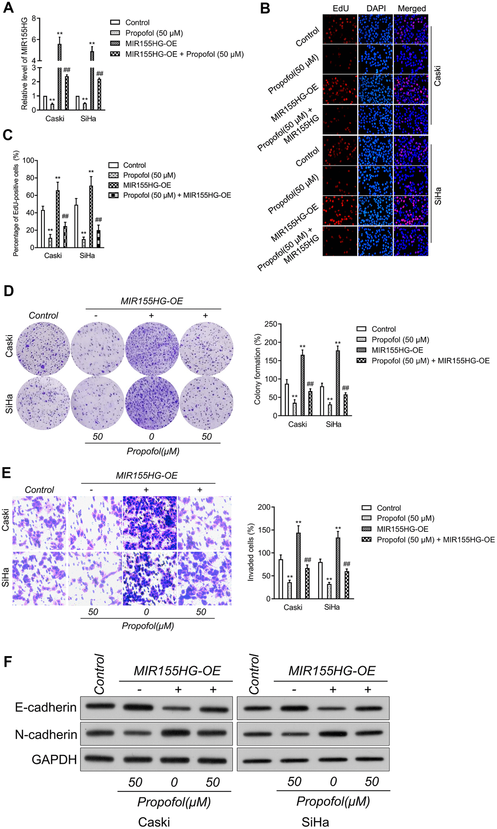 MIR155HG mediates the anti-cancer effect of propofol in cervical cancer cell. (A) MIR155HG overexpressing Caski and SiHa cells were exposed to propofol (50 μM). The level of MIR155HG was determined by qRT-PCR. (B, C) EdU staining assay showed that the proliferation of Caski and SiHa cell were increased after MIR155HG overexpression in the presence of propofol. (D) Colony formation assay showed that the growth of Caski and SiHa cell were increased after MIR155HG overexpression in the presence of propofol. (E) Transwell invasion assay showed that the invasion ability of Caski and SiHa cell were increased after MIR155HG transfection. **P##PF) The expressions levels of EMT markers in propofol-treated Caski and SiHa cells after MIR155HG transfection as determined by western blot analysis.