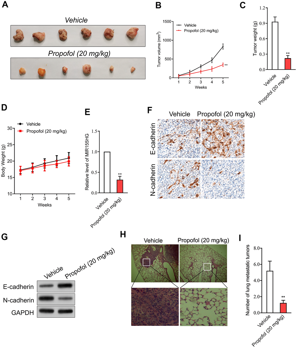 Propofol suppresses SiHa cell growth in vivo. (A) Photographs of representative tumor tissue in tumor xenografts five weeks after propofol treatment. (B) Quantitative analysis of tumor volume. (C) Quantitative analysis of tumor weight. (D) Body weight. (E) MIR155HG expressions in tumor tissue were determined by qRT-PCR. (F) The expression of E-cadherin and N-cadherin were determined using immunohistochemical staining. (G) Western blot analysis for E-cadherin and N-cadherin in tumor tissue. (H) Representative images of the histologic lung metastases were analyzed using H&E staining. (I) The number of lung metastatic tumors were graphed. **P