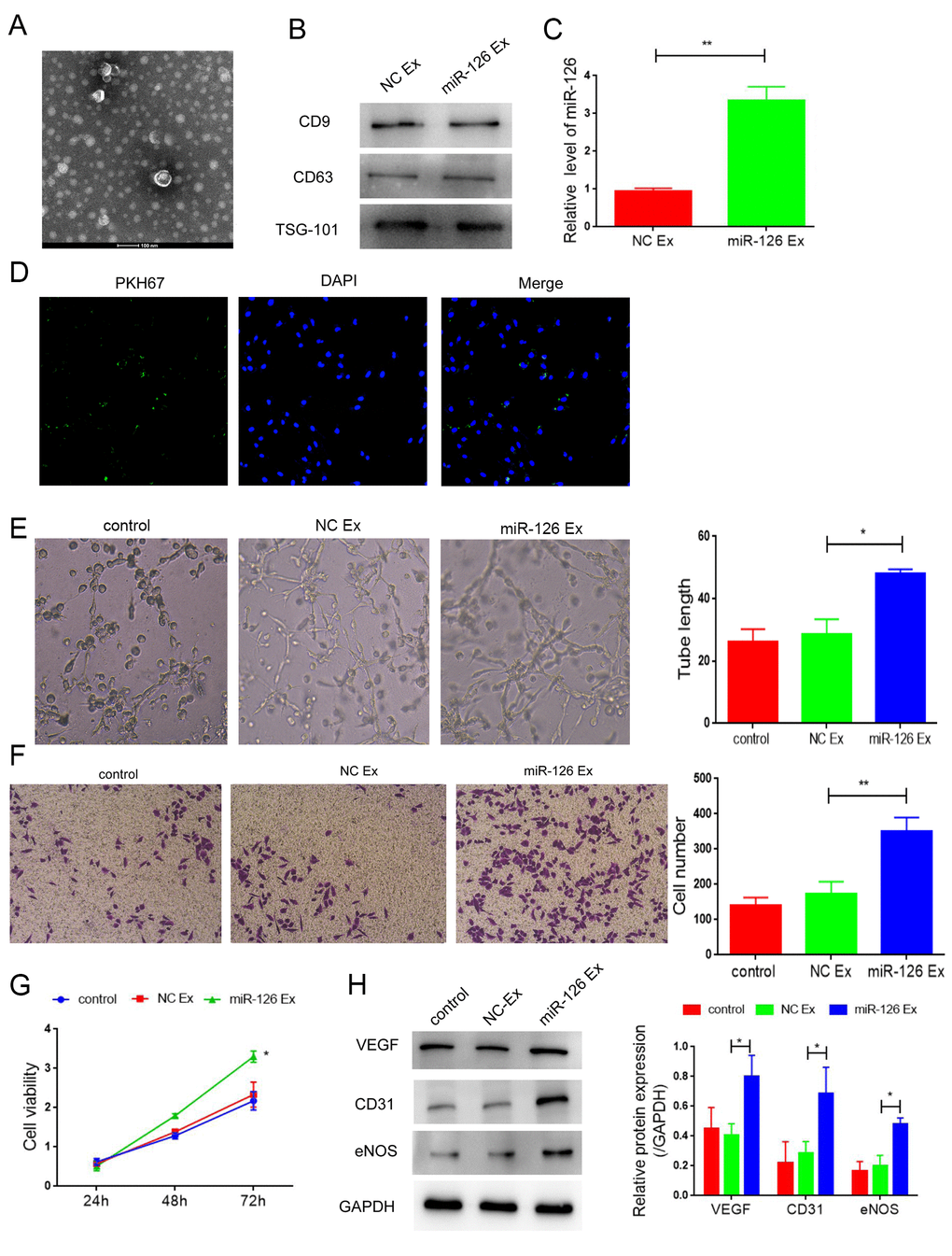 Exosomes derived from miR-126-modifified MDSCs promote angiogenesis and attenuate apoptosis in HUVECs. (A) Transmission electron photomicrograph of EXs. (B) Protein expression of CD9, CD63 and TSG-101. (C) mRNA-126 levels. (D) Confocal images of PKH67-labeled EXs taken up by HUVECs. (E) Tube formation was measured after seeding HUVECs pretreated with PBS, miR-con EXs or miR-126 EXs. Photomicrographs of tube-like structures and quantification of the tube number. (F) Representative microscopy images and quantitative analysis of apoptosis of HUVECs. (G) Cell viability. (H) Protein expression of α-SMA, CD31, vWF and VEGF in HUVECs. Data are shown as the means ± SD. *P **P 