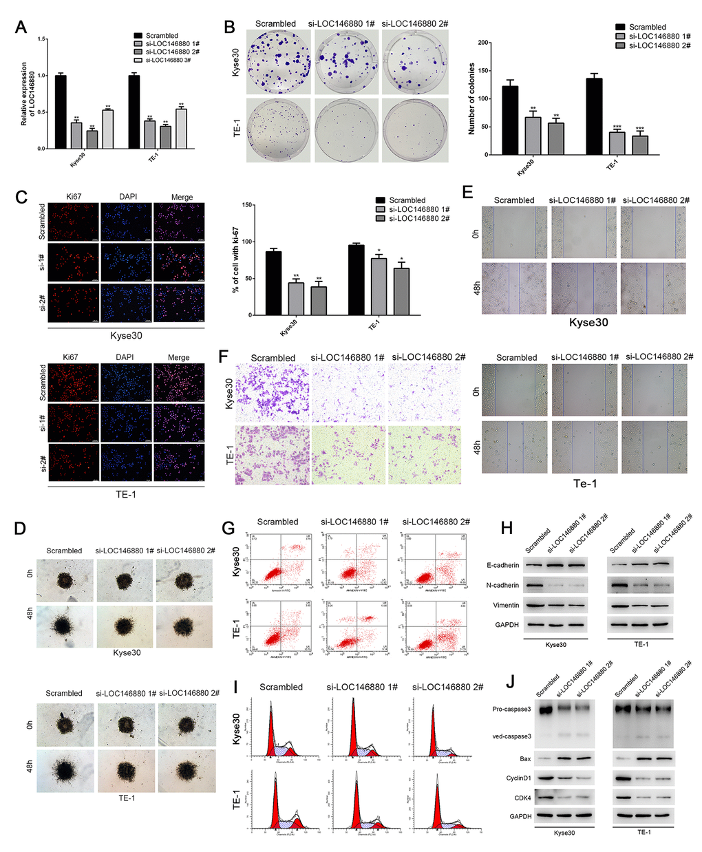 Knockdown of LOC146880 inhibits growth and progression of ESCC cells. (A) QRT-PCR analysis shows LOC146880 expression levels in ESCC cells transfected with si-NC (scrambled control siRNA), si-LOC146880#1, si-LOC146880#2, and si-LOC146880#3. (B) Colony formation assay results show viability of Kyse30 and TE-1 cells respectively transfected with si-NC, si-LOC146880#1, or si-LOC146880#2. (C) Immunofluorescence assay results show Ki-67 expression levels in control and LOC146880-silenced Kyse30 and TE-1 cells. (D) 3-dimensional spheroid assay results show the migration ability of control and LOC146880-silenced Kyse30 and TE-1 cells. (E) Wound healing assay results show the migration ability of control and LOC146880-silenced Kyse30 and TE-1 cells. (F) Transwell assay results show the invasiveness of control and LOC146880-silenced Kyse30 and TE-1 cells. (G) Flow cytometry analysis shows apoptotic rates of control and LOC146880-silenced Kyse30 and TE-1 cells. (H) Western blot analysis shows expression levels of E-cadherin (epithelial cell marker) as well as N-cadherin and vimentin (mesenchymal cell markers) in control and LOC146880-silenced Kyse30 and TE-1 cells. (I) Flow cytometry analysis shows cell cycle distribution of control and LOC146880-silenced Kyse30 and TE-1 cells. (J) Western blot analysis shows the levels of pro-apoptotic proteins (cleaved caspase-3 and Bax) and cell cycle proteins (cyclinD1 and CDK4) in control and LOC146880-silenced Kyse30 and TE-1 cells. *P 