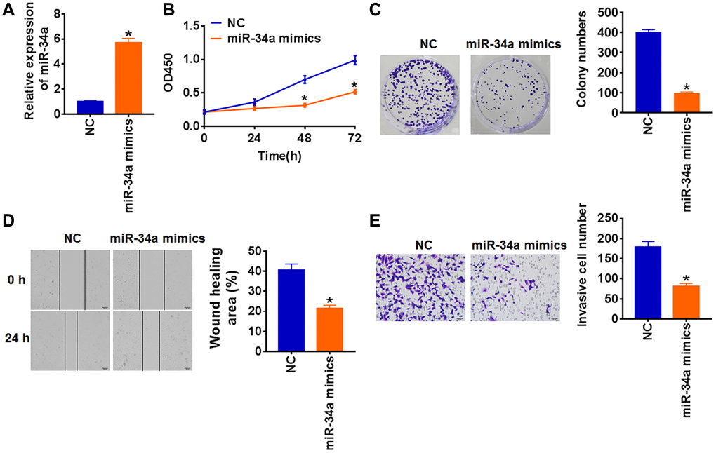 Upregulation of miR-34a inhibits proliferation, migration and invasion in TCP-1 cells. miR-34a mimics and its negative control (NC) was transfected into TCP-1 cells. (A) The expression of miR-34a was determined by qRT-PCR (*p B) CKK-8 assay was used to examine the cell growth at 0, 24, 48 and 72 h (*p C) Colony formation assay was used to calculated cell proliferation (*p D) Wound healing assay was used to detect cell migration (*p E) Transwell assay was performed to check cell invasive ability (*p 