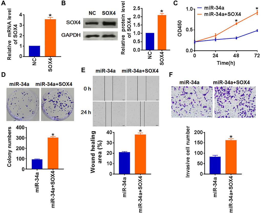 MiR-34a inhibits PTC development by downregulating SOX4. SOX4 or NC was transfected into TCP-1 cells. (A) The mRNA expression of SOX4 was determined by qRT-PCR, (B) and the protein level of SOX4 was tested by Western blot(*p C) CKK-8 assay was used to examine the cell growth at 0, 24, 48 and 72 h (*p D) Colony formation assay was used to calculated cell proliferation (*p E) Wound healing assay was used to detect cell migration (*p F) Transwell assay was performed to check cell invasive ability (*p 