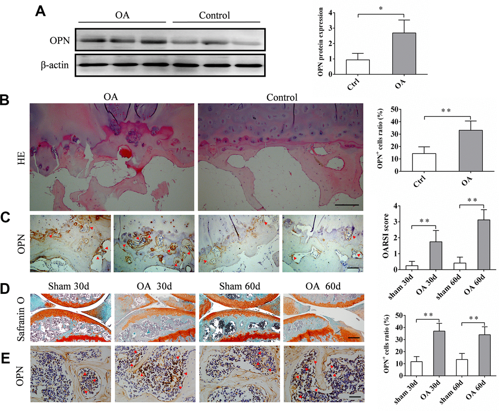 The expression of sOPN is increased in subchondral bone in OA. (A) Western blot analysis and quantification of the expression of sOPN in subchondral bone of patients with OA and control subjects. (B, C) Representative H&E, immunostaining and quantitative analysis of sOPN+ cells in the tibial subchondral bone of OA patients and control subjects. Positive cells were indicated with arrows. Scale bars = 200 μm (B), 100 μm (C), n ≥5. (D) Representative safranin O-fast green staining and OARSI scores of an OA mouse model and control group. Scale bars = 200 μm, n = 6. (E) Immunostaining and quantitative analysis of sOPN+ cells in the tibial subchondral bone of an OA mouse model and control group. Positive cells were indicated with arrows. Scale bars =50 μm, n = 6. Data are shown as mean ± s. d. and were analyzed by Student’s t test; *P .