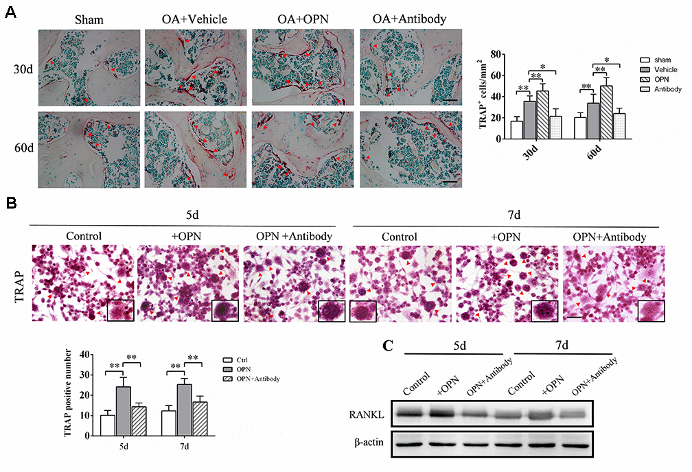 OPN promotes osteoclastogenesis in the subchondral bone in OA. (A) TRAP staining and quantitative analysis of osteoclasts in the tibial subchondral bone of an OA mouse model treated with vehicle, rmOPN or neutralizing antibody, and sham group. Positive cells were indicated with arrows; scale bars = 50 μm, n = 6. (B) TRAP staining of BMMs treated with M-CSF (20 ng/ml) and RANKL (50 ng/ml) followed by the stimulation with rmOPN (100 ng/mL) and antibody (1.0 μg/mL) for 5 or 7 days. Positive cells were indicated with arrows. TRAP-positive multinuclear cells containing more than three nuclei were counted as osteoclasts; scale bars = 50 μm, n = 6. (C) Western blot analysis of the expression of RANKL in BMMs treated with M-CSF and RANKL followed by the stimulation with rmOPN (100 ng/mL) and antibody (1.0 μg/mL) for 5 or 7 days. Data are shown as mean ± s. d and were analyzed by one-way ANOVA; *P .