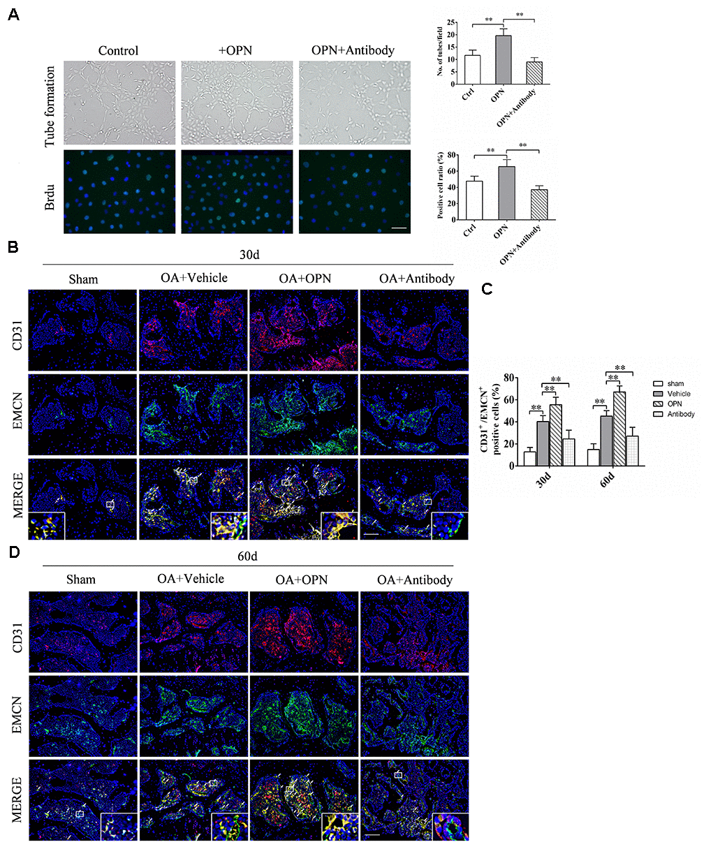 OPN promotes the formation of h-type vessels in subchondral bone of OA. (A) HUVECs were treated with rmOPN (100 ng/mL) and neutralizing antibody (1.0 μg/mL) for 24 h, and tubes were measured using a tube formation assay; scale bars = 100 μm, n = 6. (B) Representative images and quantitative analysis of Brdu (green) immunofluorescence in HUVECs treated with rmOPN (100 ng/mL) and neutralizing antibody (1.0 μg/mL) for 24 h; scale bars = 25 μm, n = 6. (C, D) Representative images and quantitative analysis of CD31 and Endomucin (EMCN) co-immunostaining in tibial subchondral bone of an OA mouse model treated with vehicle, rmOPN or neutralizing antibody, and sham group. Positive cells were indicated with arrows. Boxed area is magnified in the corner. Scale bars = 50 μm. Data are shown as mean ± s. d. and were analyzed by one-way ANOVA, n = 6, *P .