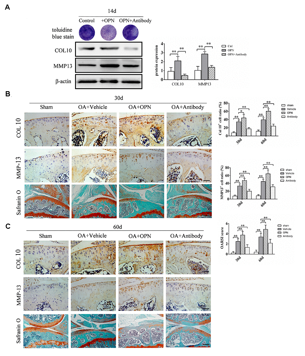 OPN accelerates the degeneration of OA articular cartilage. (A) Toluidine blue staining of ADTC5 cells treated with ITS (10 μg/mL) followed by stimulation with rmOPN (100 ng/mL) and neutralizing antibody (1.0 μg/mL) for 14 days. Western blot analysis and quantification of the expression of collagen-10 (COL10) and MMP-13 in ADTC5 cells treated with ITS followed by stimulation with rmOPN and neutralizing antibody for 14 days. (B, C) Representative immunostaining and quantitative analysis of COL10+, MMP-13+ cells in articular cartilage of an OA mouse model treated with vehicle, rmOPN or neutralizing antibody, and sham group. Scale bars = 50 μm. Safranin O-fast green staining and OARSI scores of tibial articular cartilage and subchondral bone of an OA mouse model treated with vehicle, rmOPN or neutralizing antibody, and sham group. Scale bars = 200 μm. Data are shown as mean ± s. d. and were analyzed by one-way ANOVA, n=6, *P .