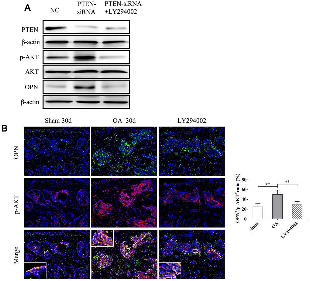 LY294002 inhibits OPN-mediated subchondral bone and cartilage degeneration in OA. (A) Western blot analysis of the expression of PTEN, p-AKT and OPN in MC3T3-E1 cells transfected with PTEN-siRNA and treated with LY294002 (10 μM) for 48 h. (B) Representative images and quantitative analysis of p-AKT and OPN co-immunostaining in the tibial subchondral bone in sham group, OA group and LY294002 treatment group. Positive cells were indicated with arrows. Boxed area is magnified in the corner. Scale bars = 50 μm, n = 6.