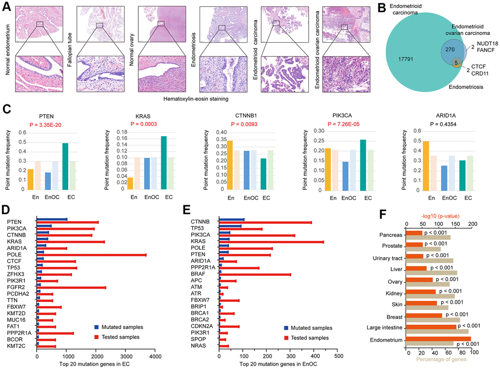 Genomic mutation features in EC, EnOC, and En. (A) Hematoxylin-Eosin staining of EC and EnOC and En samples. (B) Mutant genes of EC and EnOC and En. (C) Point mutation frequency of five common mutant genes (PTEN, KRAS, CTNNB1, PI3K3CA, and ARID1A) in EC, EnOC, and En, the left column was the observed point mutation frequency, and the right was the expected point mutation frequency. (D) Top 20 mutation genes in EC, which were rank ordered following the number of mutated samples. (E) Top 20 mutation genes in EnOC. (F) The mutation percentage of the 17791 genes in various organs.