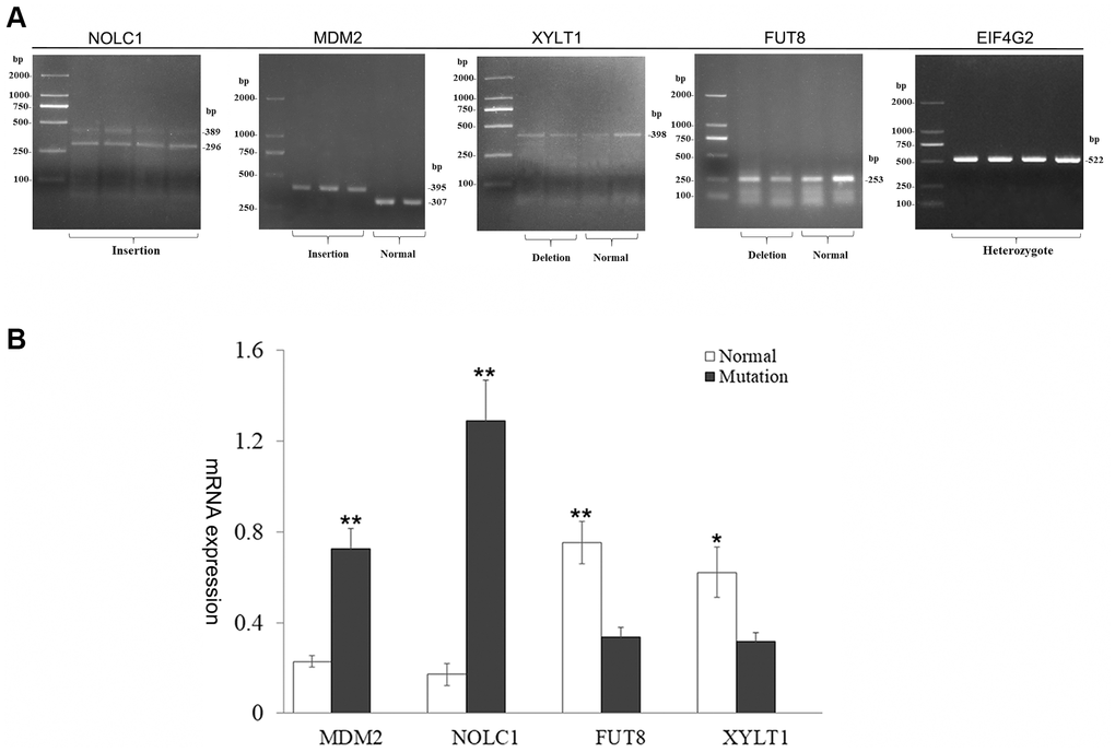 Characterization of harboring SV gene. (A) Analysis of gene transcripts across SV breakpoints. Two transcripts of MDM2 and NOLC1 genes were produced, and the other genes remained unchanged. (B) Bar graphs show qRT-PCR evaluation of MDM2, NOLC1, FUT8, XYLT1 genes. Values are mean ± SEM. t-Test: *, ** indicate PP