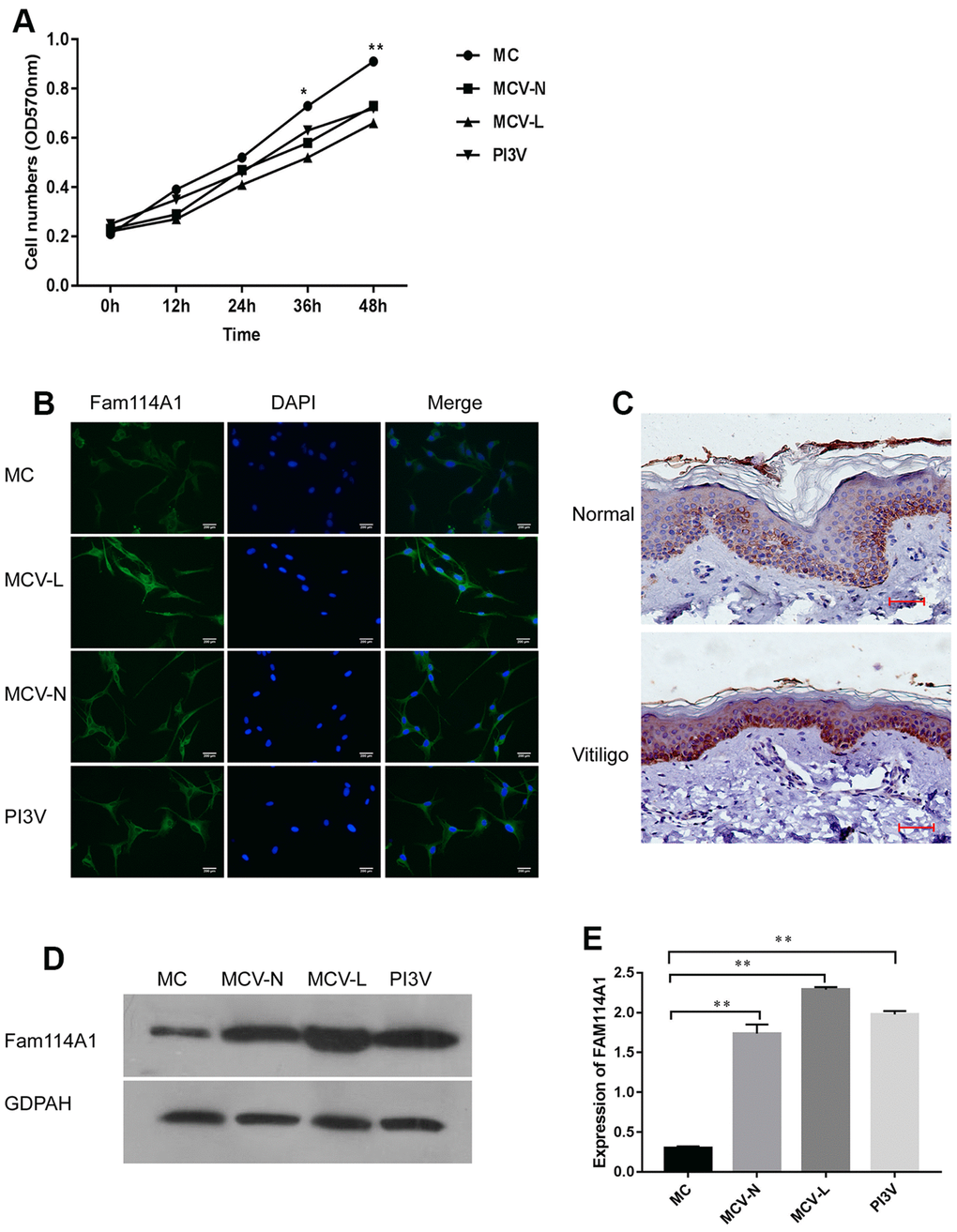 Expression of Fam114A1 in the normal and vitiligo melanocytes. (A) Comparing the growth rate of melanocytes from three different sources, it can be seen that the growth rate of melanocytes from around the skin lesions or normal parts of patients with vitiligo and the immortalized cell line PI3V of vitiligo are significantly slower than normal melanocytes. Statistical analyses were performed using one-way ANOVA and Dunnett’s post hoc test:*PB) The expression of Fam114A1 in melanocytes from different sources was detected by immunofluorescence (200×). (C) Immunohistochemical analysis of vitiligo skin lesions and normal human skins showed that Fam114A1 protein was highly expressed in the local skin lesions of vitiligo; (D, E) The expression of Fam114A1 in vitiligo melanocytes (MCV-L, MCV-N, PI3V) was confirmed by western blot, and significantly statistical results was shown. Statistical analyses were performed vs. MC using one-way ANOVA and Dunnett’s post hoc test: **P 